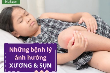 Bệnh lý nào ảnh hưởng đến phát triển xương và sụn?