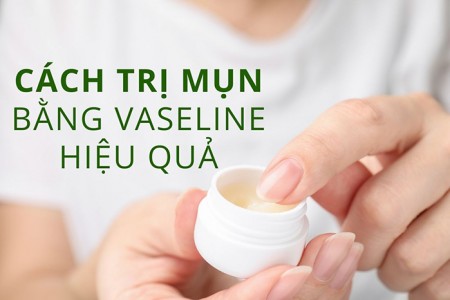 Cách trị mụn bằng vaseline hiệu quả sau vài phút