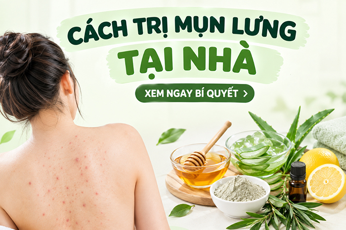 Cách trị mụn lưng tại nhà đơn giản hiệu quả
