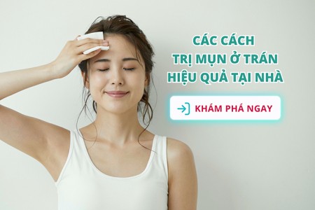 Cách trị mụn ở trán hiệu quả tại nhà chỉ trong 1 tuần