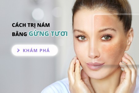Cách trị nám bằng gừng tươi an toàn, hiệu quả