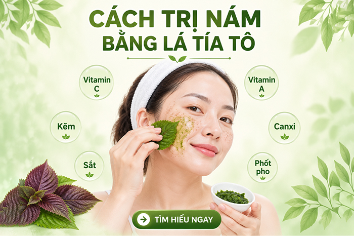 Cách trị nám bằng lá tía tô đơn giản hiệu quả nhanh tại nhà