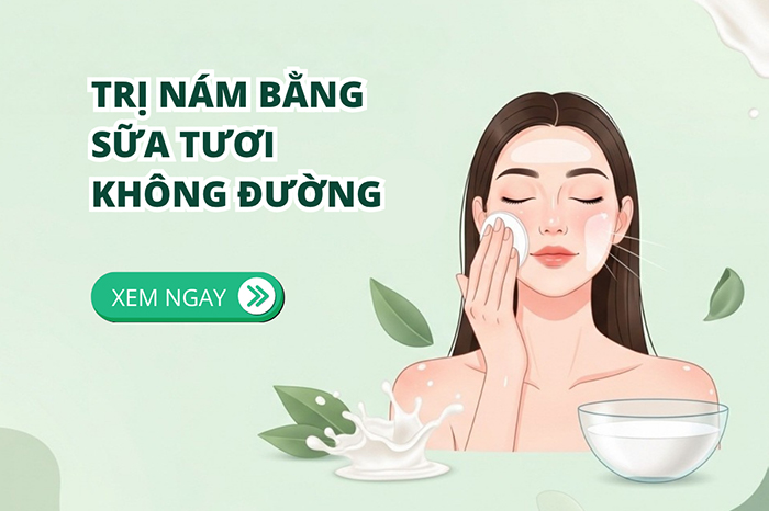 Cách trị nám bằng sữa tươi không đường đơn giản hiệu quả