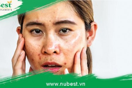 Các bước skincare cho da thường, dầu mụn vào ban đêm và ban ngày