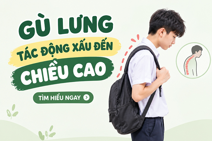 Gù lưng ảnh hưởng xấu đến chiều cao như thế nào?