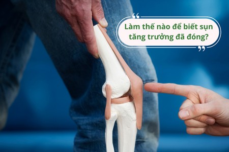 Làm thế nào để biết sụn tăng trưởng đã đóng?