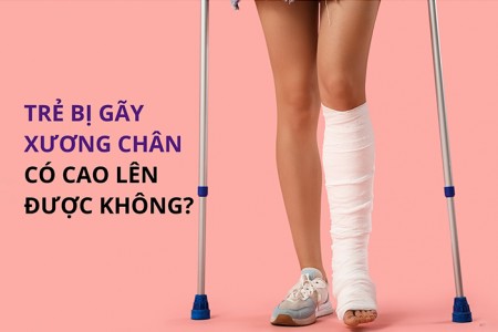 Trẻ bị gãy xương chân có còn tăng chiều cao được không?