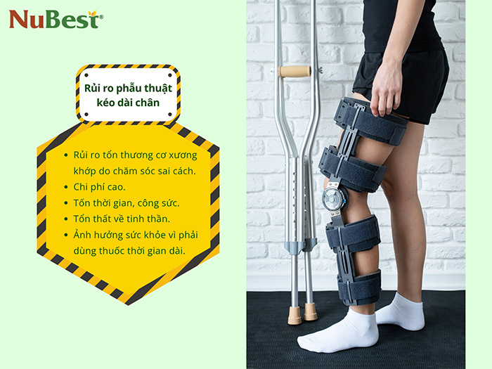 Phẫu thuật kéo dài chân chứa nhiều rủi ro sức khỏe