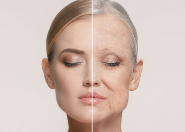 Da chảy xệ khiến gương mặt trở nên già nua