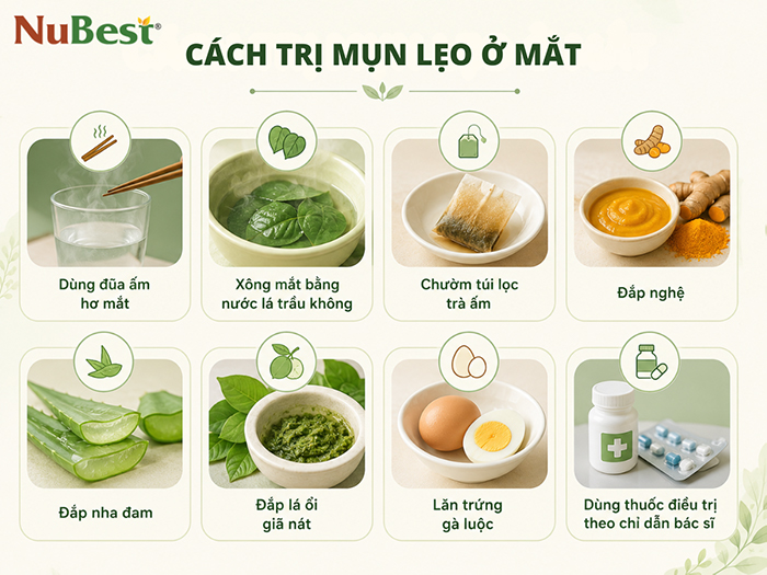 Một số cách trị mụn lẹo ở mắt bạn có thể tham khảo.