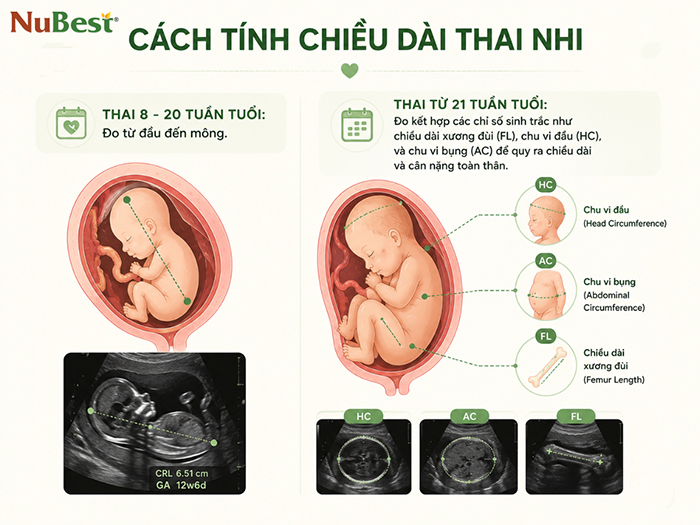 Chiều dài thai nhi thường được xác định thông qua siêu âm.