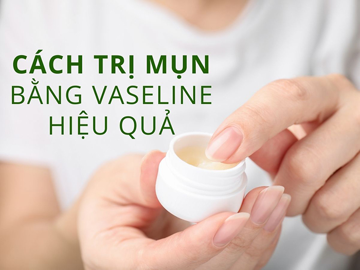 Hướng dẫn chi tiết cách trị mụn bằng vaseline