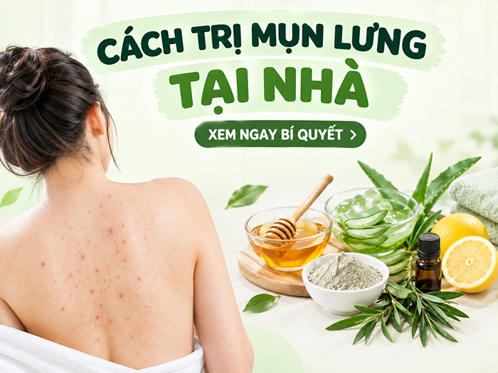 Mụn lưng có thể giải quyết ngay tại nhà nếu bạn biết cách.