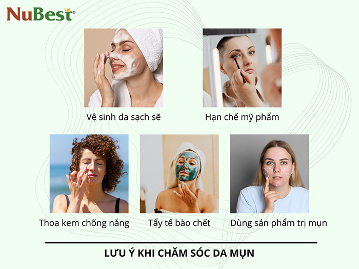 Lưu ý chăm sóc da để hạn chế mụn, cải thiện da khỏe đẹp