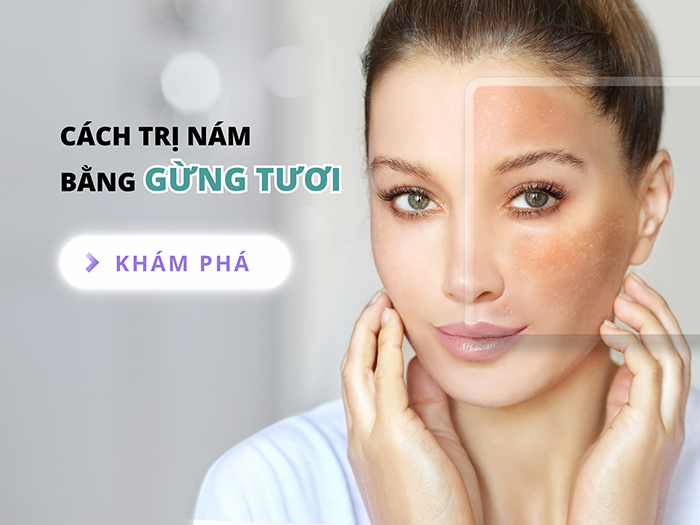 Trị nám bằng gừng tươi có thể thể thực hiện ngay tại nhà