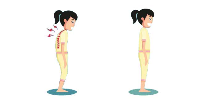 cải thiện tư thế là cách tăng chiều cao tuổi 20 hiệu quả