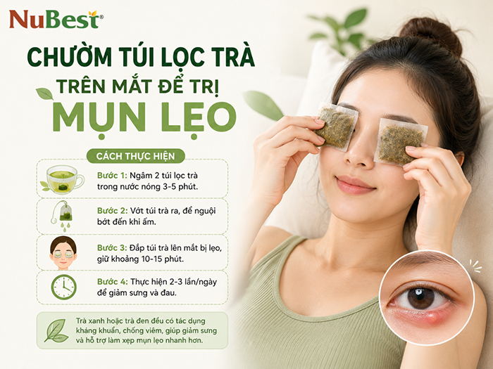 Chườm mắt bằng túi lọc trà ấm hoặc túi chườm ấm giúp nhanh khỏi lẹo.