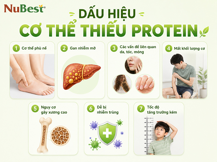 Dấu hiệu cơ thể thiếu Protein cần theo dõi kỹ.
