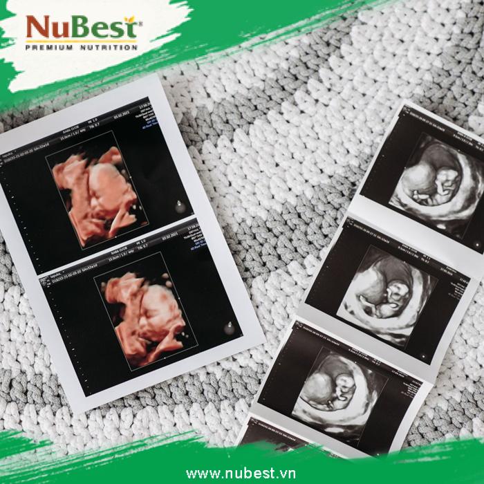 Siêu âm hay xét nghiệm được cho là phương pháp chẩn đoán giới tính thai nhi chuẩn xác và nhanh chóng nhất
