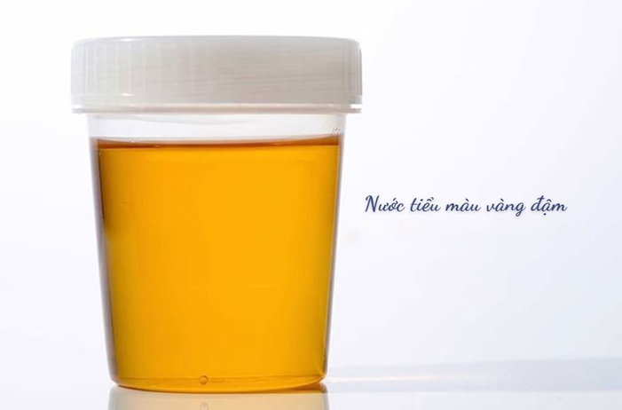 Khi mang thai bé gái, nồng độ hormone urochrome tăng cao nên nước tiểu có màu đậm hơn hẳn