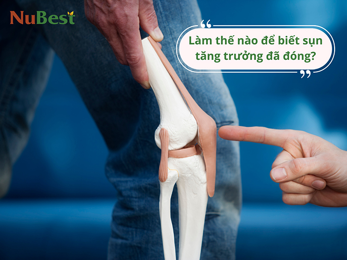 Khi sụn tăng trưởng đóng, chiều cao ngừng phát triển