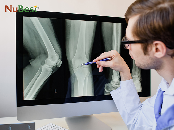 Phim chụp X-quang giúp ba mẹ nhận biết sụn tăng trưởng của trẻ đã đóng hay chưa