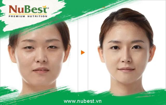 Sự thay đổi của khuôn mặt khi kết hợp kỹ thuật massage chống lão hóa Asahi vào quy trình skincare