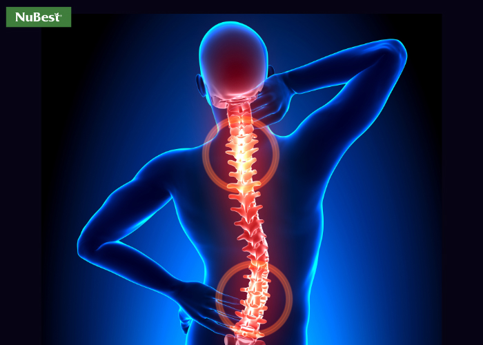 Loãng xương ngày càng gia tăng và phát hiện ở nhóm đối tượng trẻ tuổi