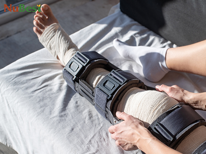 Phẫu thuật kéo dài xương chân là phương pháp can thiệp tiềm ẩn nhiều rủi ro