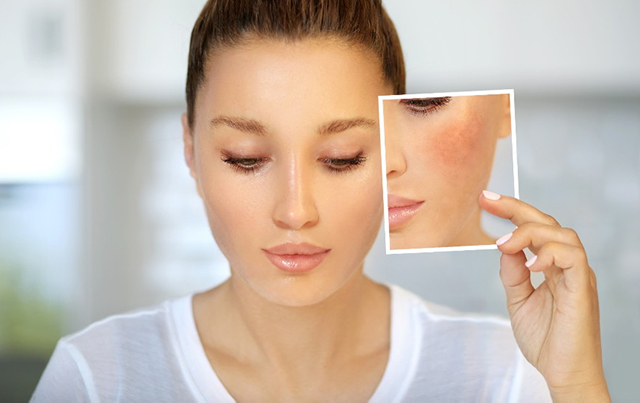 Công thức baking soda + mật ong giúp loại bỏ nhanh chóng mụn đầu đen trên da