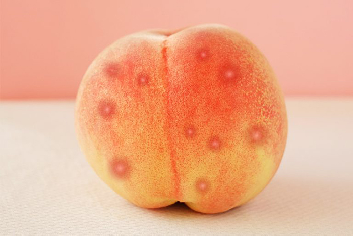 Mụn ở mông xuất phát từ đâu, làm thế nào để trị mụn mông nhanh chóng?