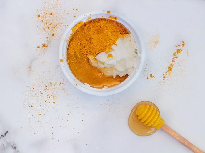 Trị nám bằng nghệ và mật ong là công thức được nhiều nàng áp dụng