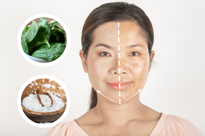 Muối kết hợp rau mồng tơi không chỉ trị nám mà còn kháng khuẩn, giảm viêm