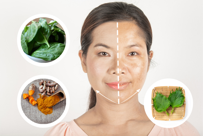 Bộ ba trị nám hữu hiệu mồng tơi, tinh bột nghệ và lá tía tô