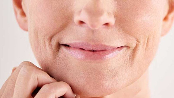 Nếp nhăn ở khóe miệng có thể bắt nguồn từ quá trình lão hóa tự nhiên của cơ thể